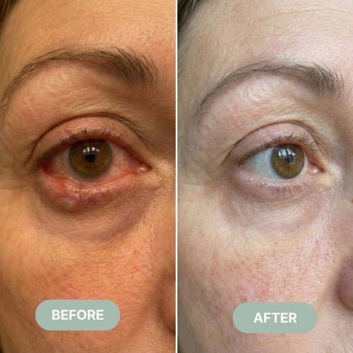 Steam Sight™- Ultimate Eye Relief Device!